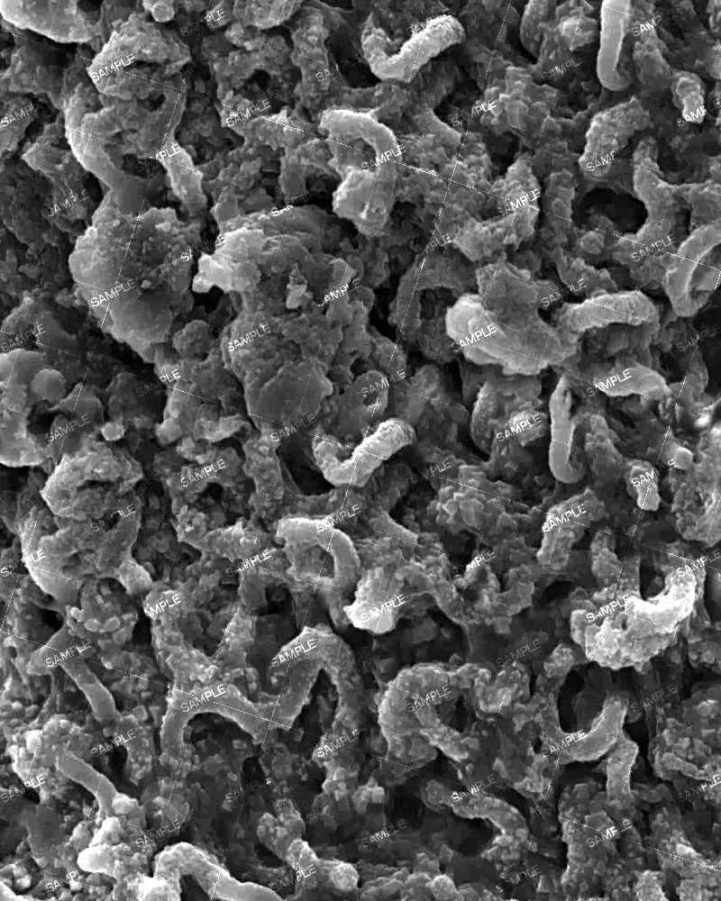 Bacterium Under Microscope