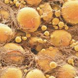 Fat-Cells
