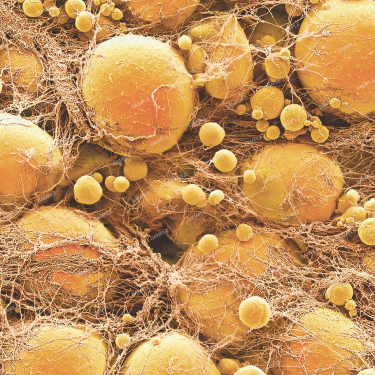 Fat Cells