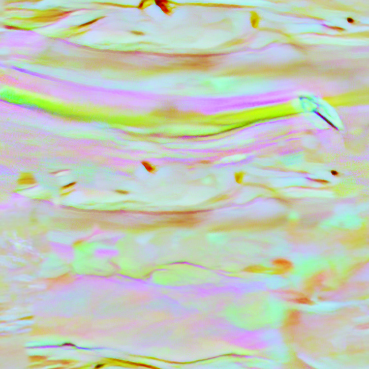 Mother of Pearl 5