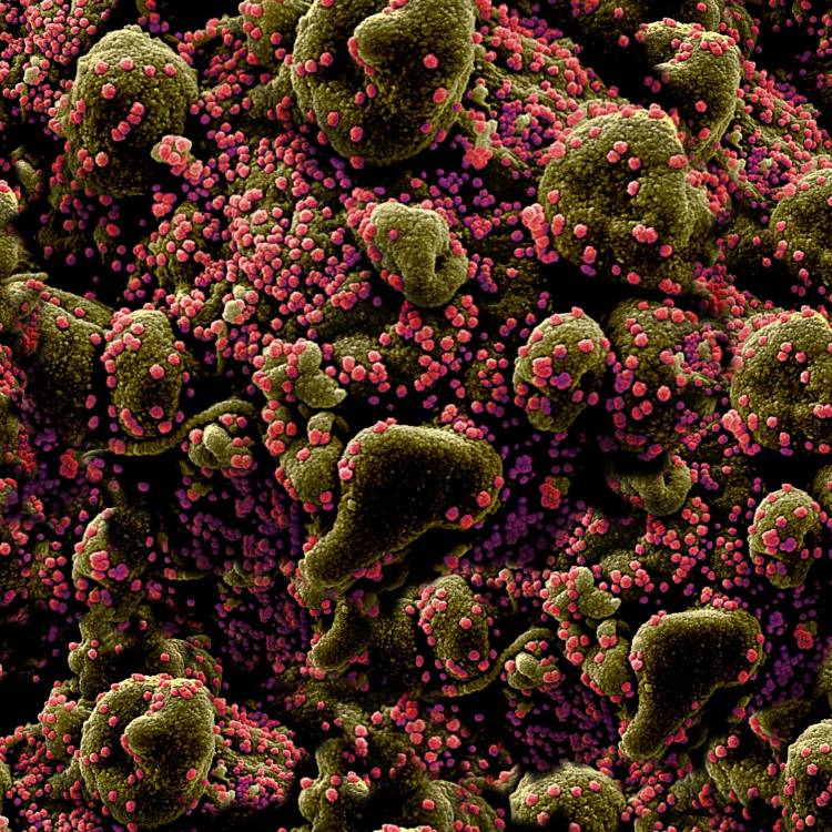 Pink Virus on Green Cells