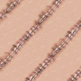 Stitches-Sutures